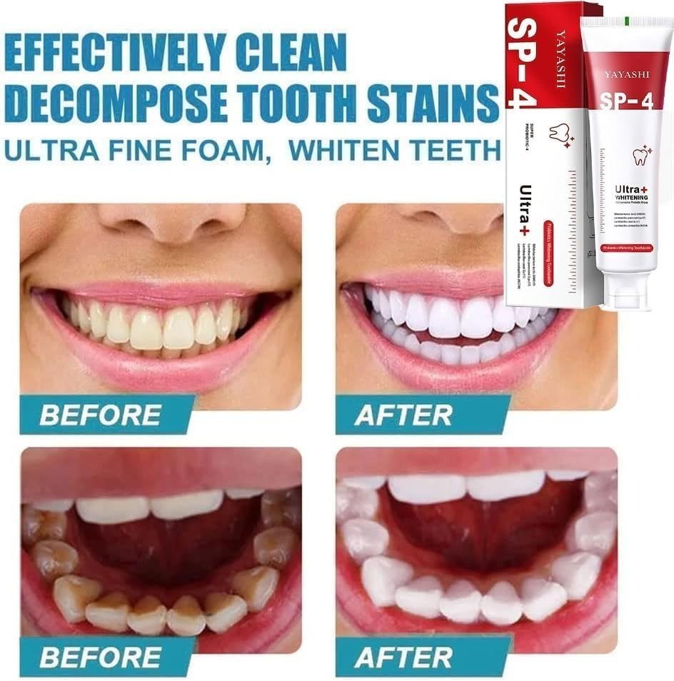 Teeth Whitening Serum with Brush for Pakistani Smile Brightening